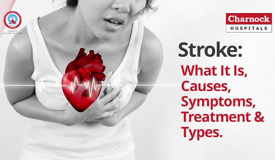 Stroke: What It Is, Causes, Symptoms, Treatment & Types.