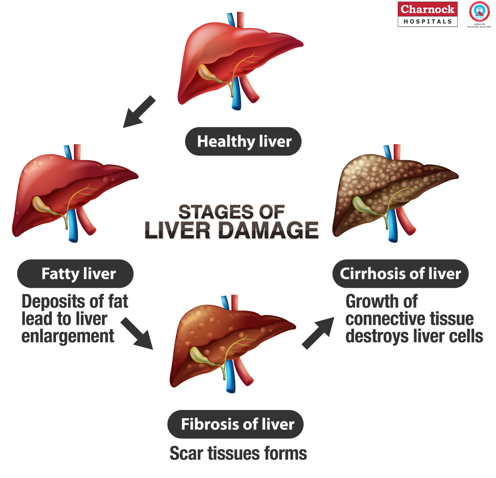 Liver Damage